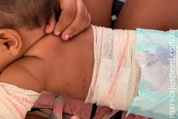 Homem acerta fogos em bebê ao ser cobrado uso de máscara em bar de Goiás