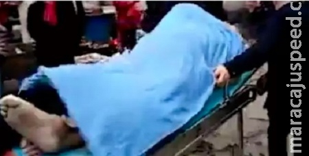 Homem passa cola no pênis e morre durante relação sexual 