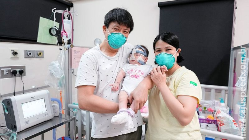 Menor bebê prematuro do mundo, nascida com peso de uma maçã, tem alta após 13 meses Menor bebê prematuro do mundo, nascida com peso de uma maçã, tem alta após 13 meses