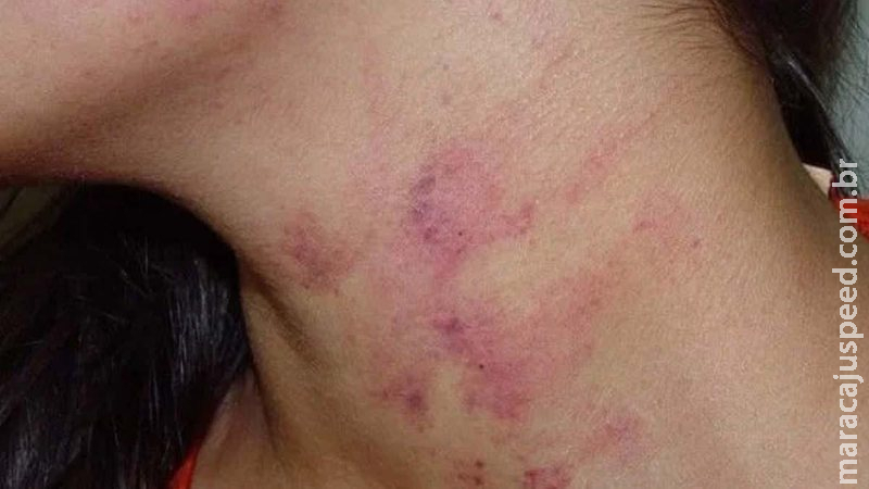 Mensagem no celular acaba em quebra-quebra e jovem agredida por namorado