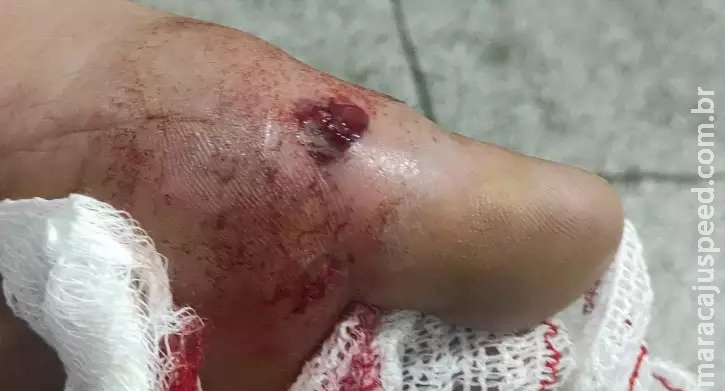 Morador em Fátima do Sul leva tiro no pé ao cobrar empresário da Capital a conclusão de serviços em veículo 