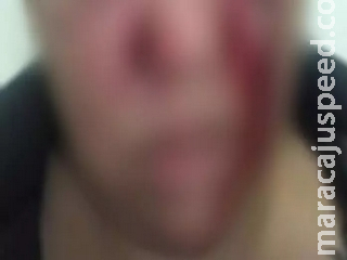 Motorista de caminhonete é alvejado a tiros na fronteira de MS