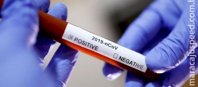 Números de casos e mortes por Covid caiu 50% no Estado Números de casos e mortes por Covid caiu 50% no Estado