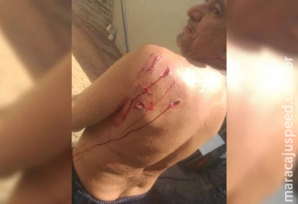 Capivara ataca banhista e o deixa ferido em cena inusitada