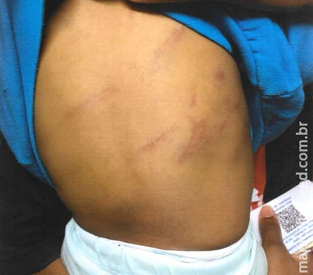 Homem espanca esposa e enteado de 2 anos em Nova Alvorada do Sul Homem espanca esposa e enteado de 2 anos em Nova Alvorada do Sul
