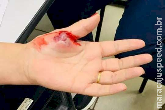 Mulher é presa após atacar médica e arrancar sangue de técnica de enfermagem Mulher é presa após atacar médica e arrancar sangue de técnica de enfermagem