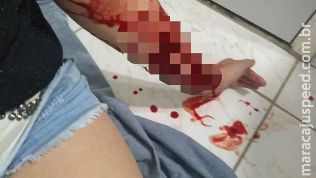 PMs salvam mulher que tentava se matar no Caiobá II PMs salvam mulher que tentava se matar no Caiobá II