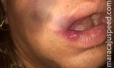 ‘Tem que apanhar que nem homem’: travesti é espancada por dupla na rua em MS ‘Tem que apanhar que nem homem’: travesti é espancada por dupla na rua em MS