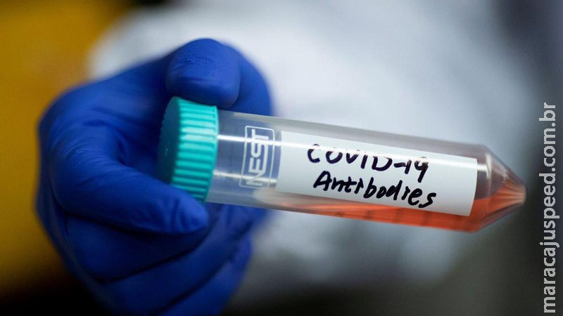 Brasil registra 199 mortes pela covid em 24h; média volta a ficar abaixo de 500 Brasil registra 199 mortes pela covid em 24h; média volta a ficar abaixo de 500