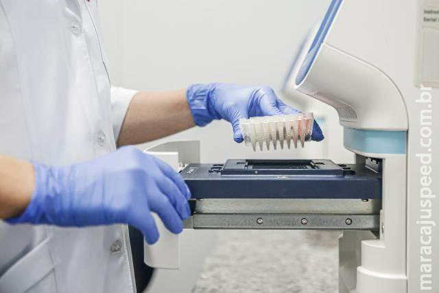 Covid-19: Brasil registra 6,2 mil novos casos e 187 óbitos Covid-19: Brasil registra 6,2 mil novos casos e 187 óbitos