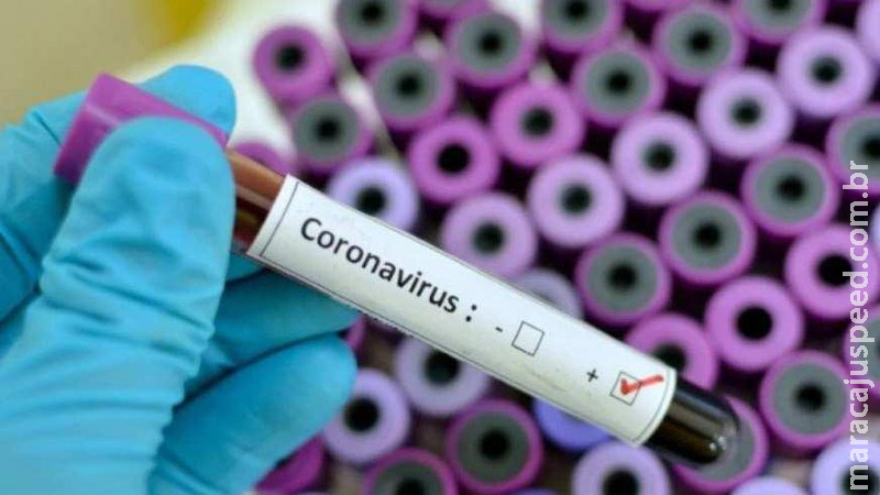 Covid-19: casos sobem para 21,6 milhões e mortes, para 602 mil Covid-19: casos sobem para 21,6 milhões e mortes, para 602 mil
