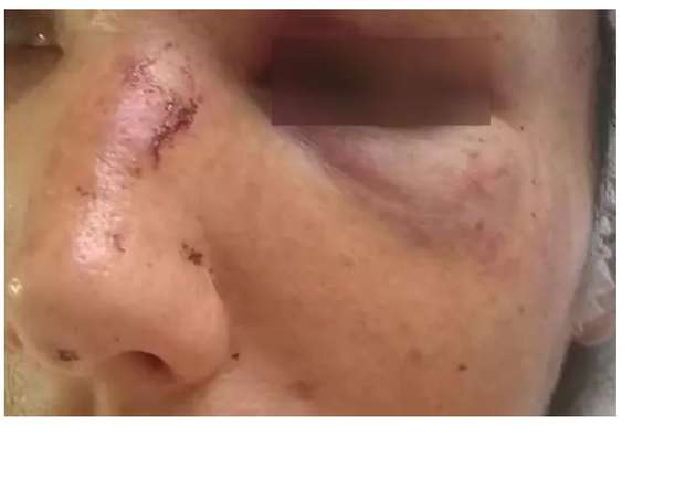 Mulher pede para sogra ficar com filhos e apanha no Tiradentes