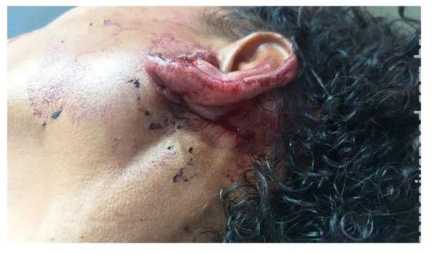 Brasileira leva 4 tiros e sobrevive na fronteira de MS Brasileira leva 4 tiros e sobrevive na fronteira de MS