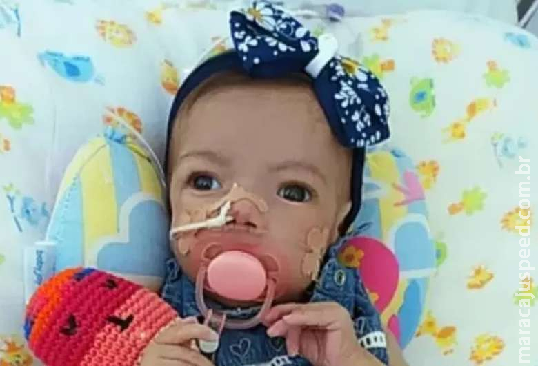 Com doença rara, família pede ajuda para que Lívia tenha conforto