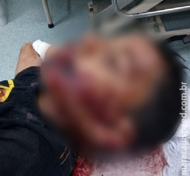 Menino autista é achado com sinais de tortura após desaparecer em Sorocaba Menino autista é achado com sinais de tortura após desaparecer em Sorocaba
