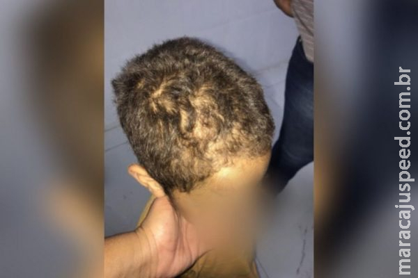 Pai e madrasta são presos por torturar criança de 7 anos em Goiás Pai e madrasta são presos por torturar criança de 7 anos em Goiás