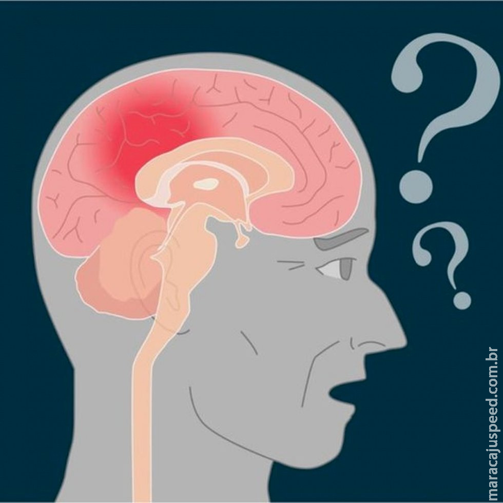 Vacina contra Alzheimer começa a ser testada em humanos Vacina contra Alzheimer começa a ser testada em humanos