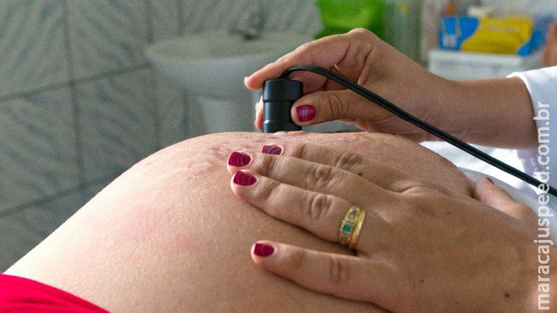 ANS lança campanha contra cesarianas desnecessárias ANS lança campanha contra cesarianas desnecessárias