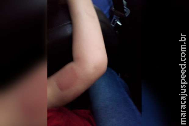 Família desmente versão de diretora e explica que criança tem alergia Família desmente versão de diretora e explica que criança tem alergia