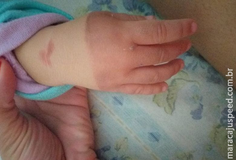 Mãe denuncia maus-tratos de babás contra bebê de um ano Mãe denuncia maus-tratos de babás contra bebê de um ano