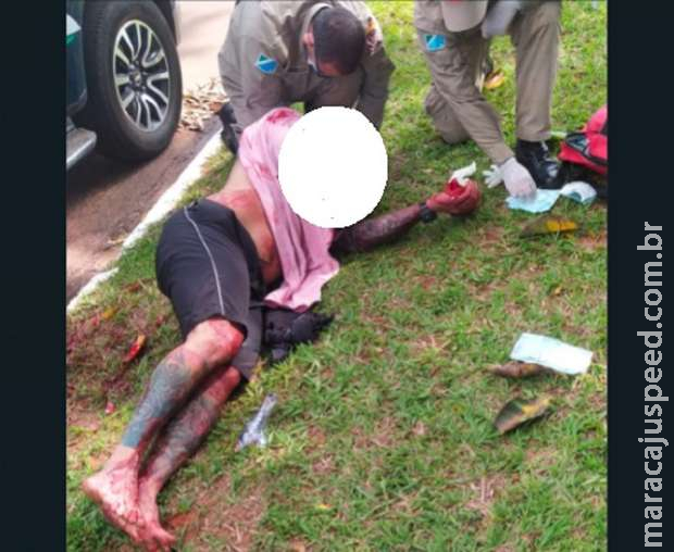 Personal baleado na boca em motel deve fazer nova cirurgia em Campo Grande Personal baleado na boca em motel deve fazer nova cirurgia em Campo Grande