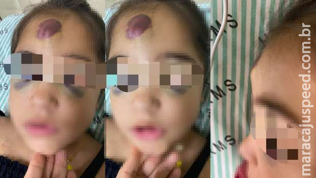 Berço com grade quebrada despenca e criança cai com rosto no chão no Hospital Regional Berço com grade quebrada despenca e criança cai com rosto no chão no Hospital Regional