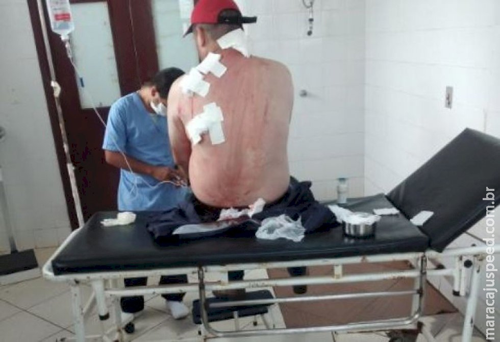 Comerciante é atingido por vários tiros e se salva de atentado na fronteira Comerciante é atingido por vários tiros e se salva de atentado na fronteira
