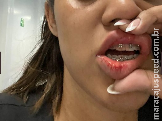 Enfermeira é agredida com soco e arranhões por acompanhante de paciente