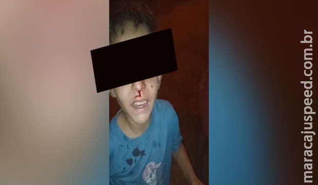 Menino é espancado e mãe acusa madrasta em Ribas: 