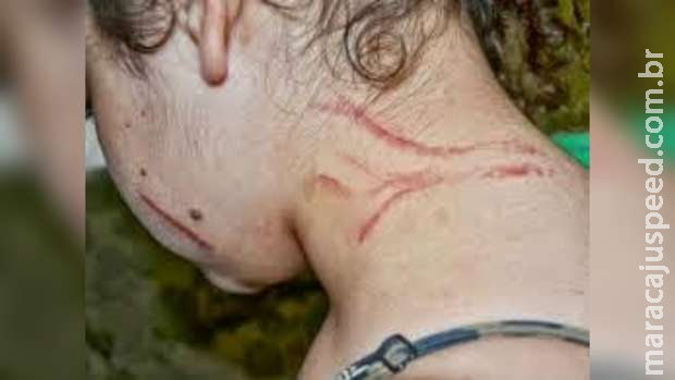 Mulher é agredida a unhadas e quase esfaqueada por prima trans em Campo Grande Mulher é agredida a unhadas e quase esfaqueada por prima trans em Campo Grande