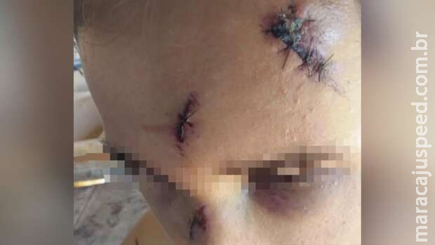 Estudante foi brutalmente espancado pela PM de Amambai, denuncia advogado Estudante foi brutalmente espancado pela PM de Amambai, denuncia advogado