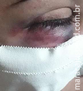 Mãe aciona polícia após levar socos do filho em Dourados Mãe aciona polícia após levar socos do filho em Dourados
