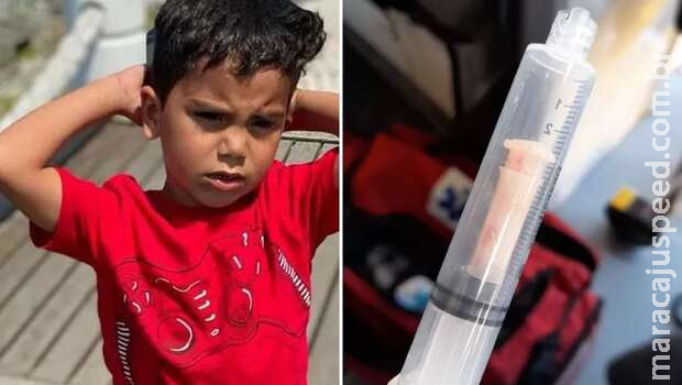 Menino que engoliu apito morre e família doa órgãos: 