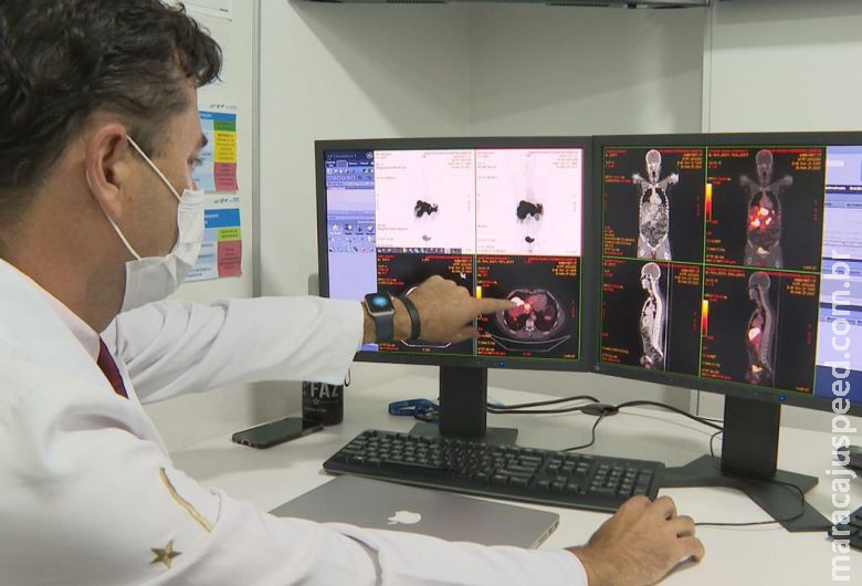 Metade dos pacientes do SUS com câncer se tratam fora de suas cidades Metade dos pacientes do SUS com câncer se tratam fora de suas cidades