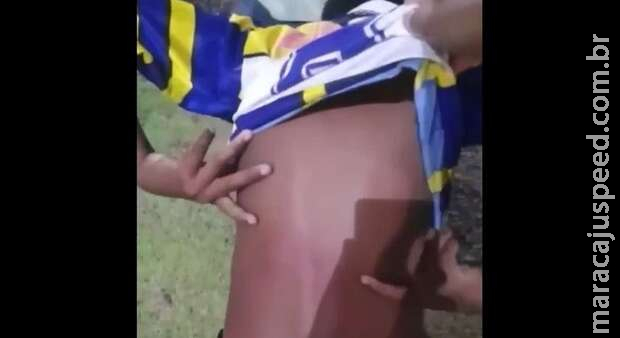 Segurança do Burger King bate em menino com cinto Segurança do Burger King bate em menino com cinto