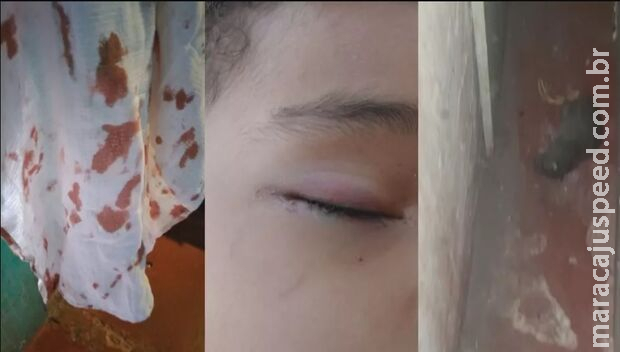 Criança de 3 anos é ferida nos olhos após ser mordida por rato enquanto dormia Criança de 3 anos é ferida nos olhos após ser mordida por rato enquanto dormia
