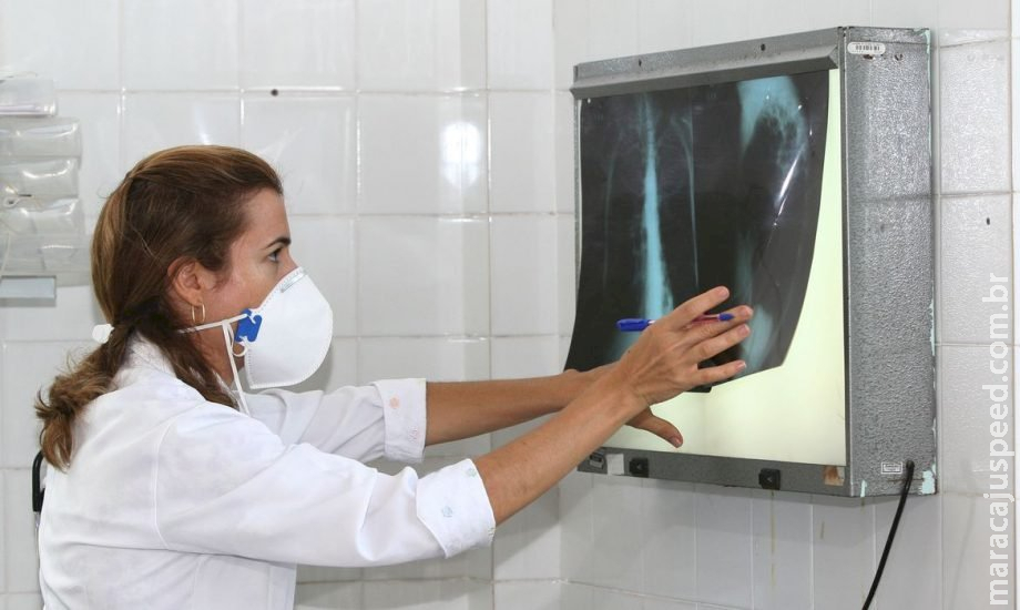 Dia Mundial da Tuberculose: MS registrou 1,2 mil casos da doença em um ano Dia Mundial da Tuberculose: MS registrou 1,2 mil casos da doença em um ano