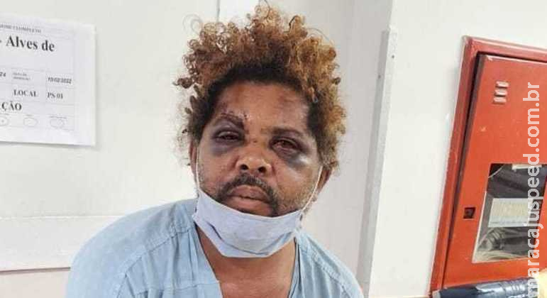Morador de rua agredido por personal é retirado de cidade por segurança Morador de rua agredido por personal é retirado de cidade por segurança