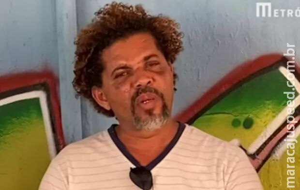 Morador de rua agredido por personal que flagrou sexo com mulher fala que não fez mal nenhum Morador de rua agredido por personal que flagrou sexo com mulher fala que não fez mal nenhum