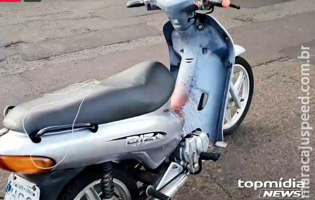 Motociclista que quase foi degolada por linha de pipa sai do coma Motociclista que quase foi degolada por linha de pipa sai do coma