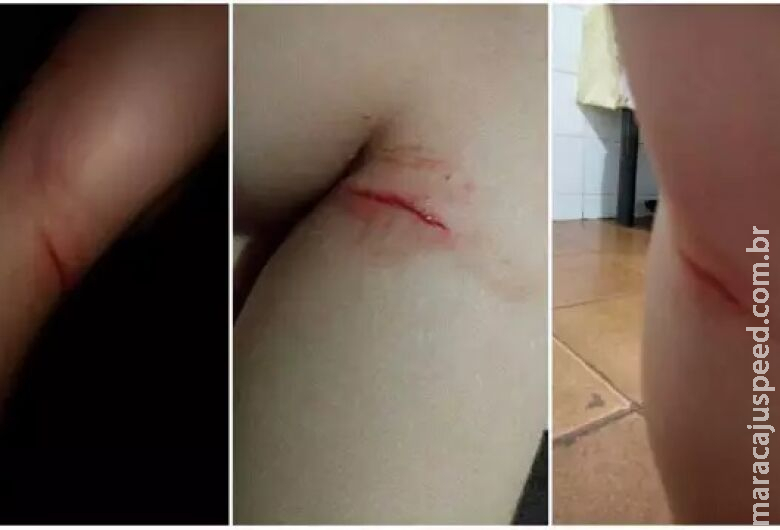 Avós são acusados de agredir netos de 4 e 7 anos com pedaço de pau Avós são acusados de agredir netos de 4 e 7 anos com pedaço de pau