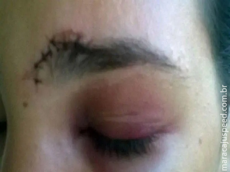 Funcionária de bar é roubada e agredida a soco por cliente em cidade de MS