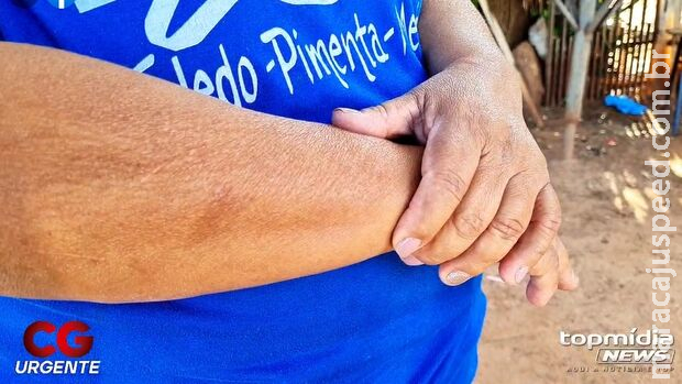 Família de doméstica diz que marido simulou tentativa de suicídio para Família de doméstica diz que marido simulou tentativa de suicídio para