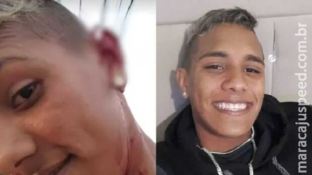 Gari deixa saco de lixo rasgar e tem orelha rasgada por morador no Paraná