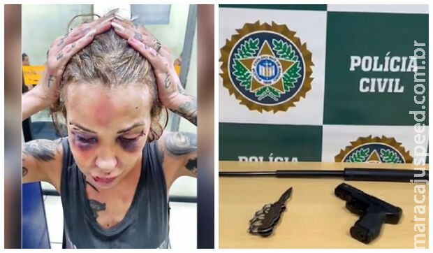 Jornalista é agredida pelo namorado durante três dias com cassetete e soco inglês no RJ Jornalista é agredida pelo namorado durante três dias com cassetete e soco inglês no RJ