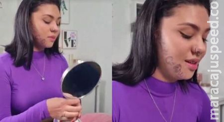 Jovem que teve rosto tatuado pelo ex começa sessões para retirada: Jovem que teve rosto tatuado pelo ex começa sessões para retirada: