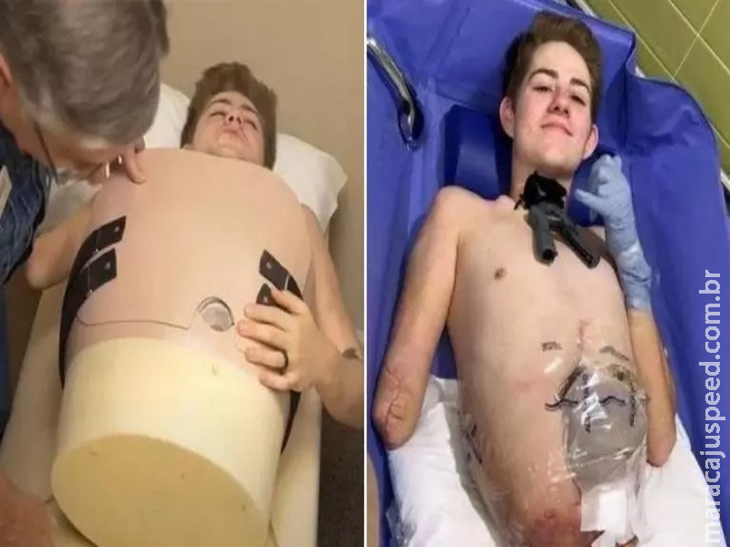 Milagre da medicina: Jovem cortado ao meio pede a médico para Milagre da medicina: Jovem cortado ao meio pede a médico para