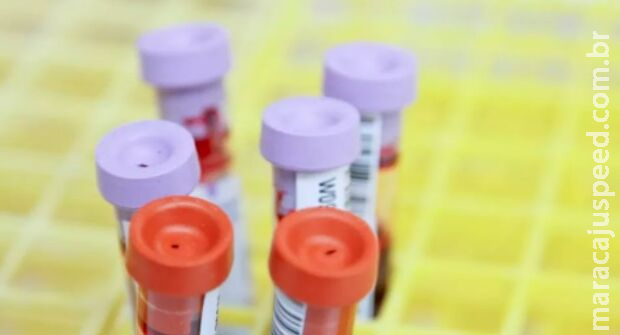 Saúde investiga seis mortes por suspeita de hepatite misteriosa em crianças e adolescentes Saúde investiga seis mortes por suspeita de hepatite misteriosa em crianças e adolescentes
