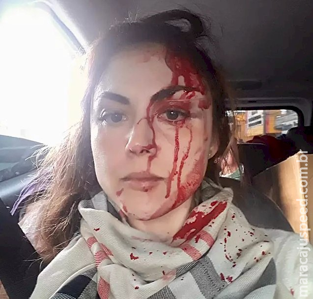 Procuradora espancada em SP revela que Procuradora espancada em SP revela que