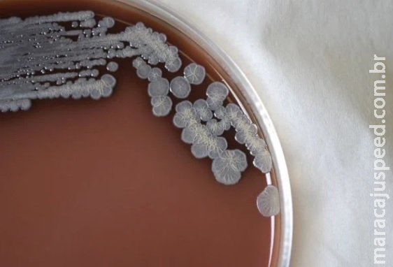 Bactéria misteriosa deixa saúde dos Estados Unidos em alerta